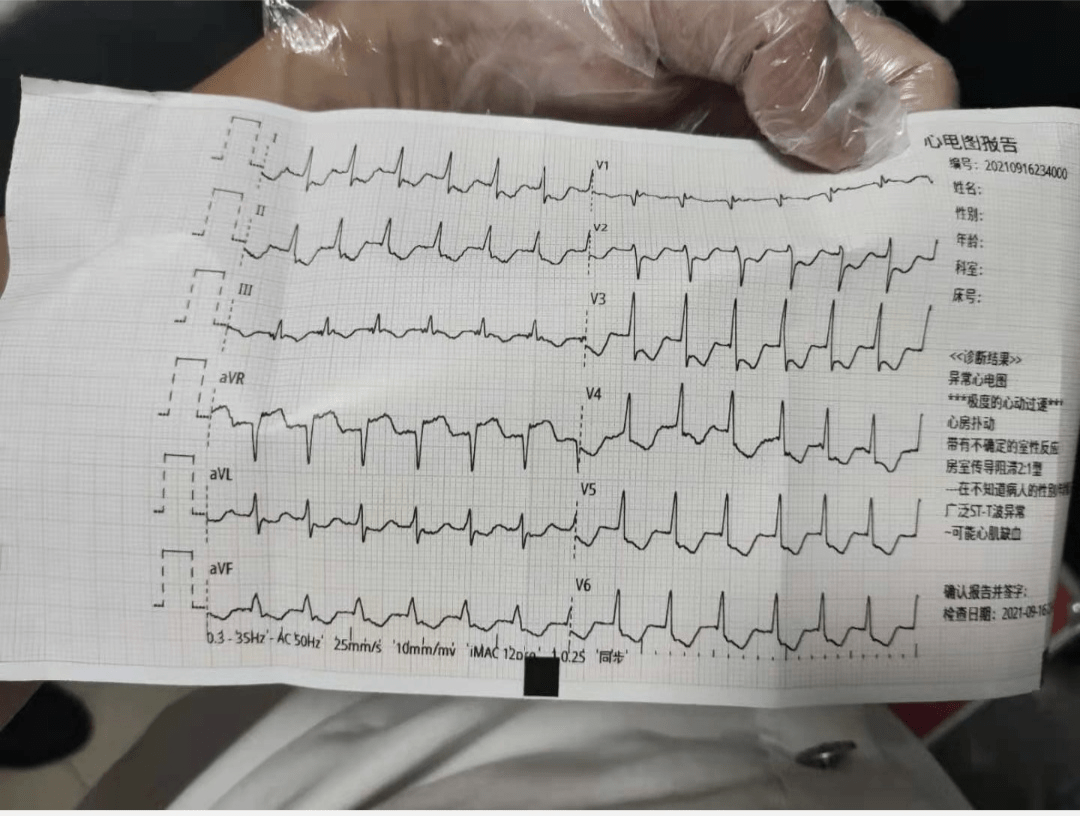 女士只是心慌30分钟,做完心电图后,为啥心脏专家说:九死一生