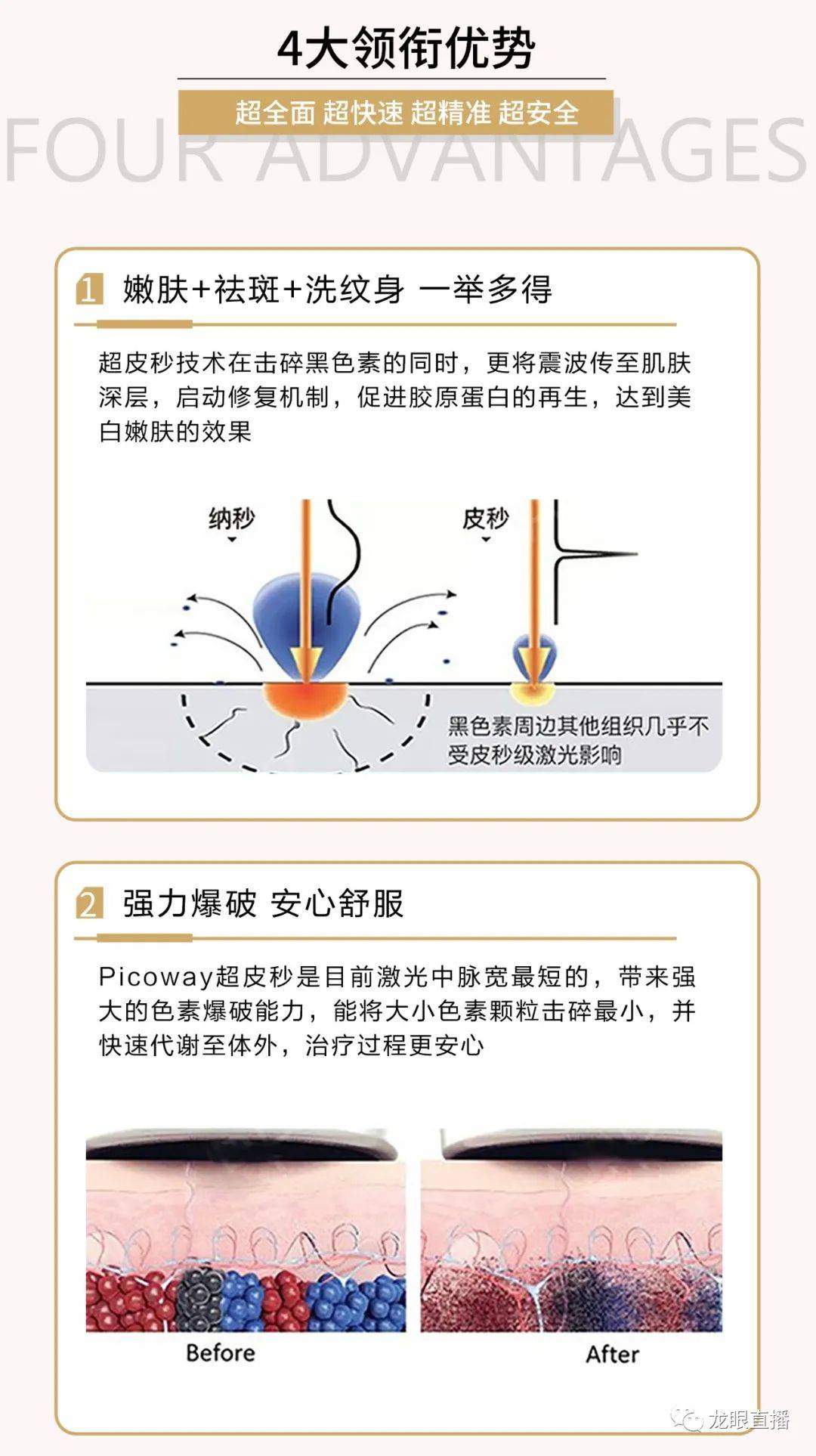 女士|?汇聚世界之美，共筑妙曼之光！多图回顾妙曼医美《超皮秒·秒出滤镜颜》新品发布会