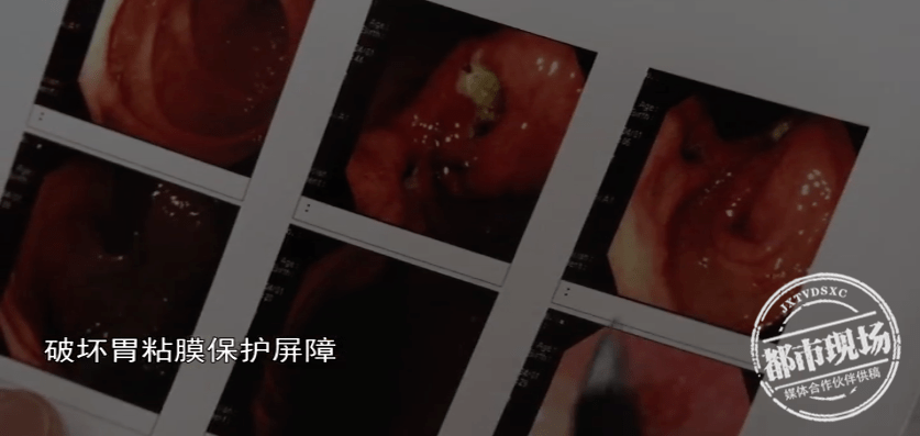 李女士|女子连续三天吃月饼当晚餐，半夜突然吐血！医生建议少量多餐