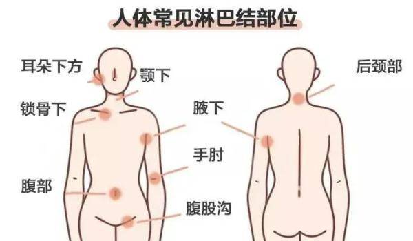 功能|淋巴肿了，疼比不疼好！危险的淋巴结有这几个特点