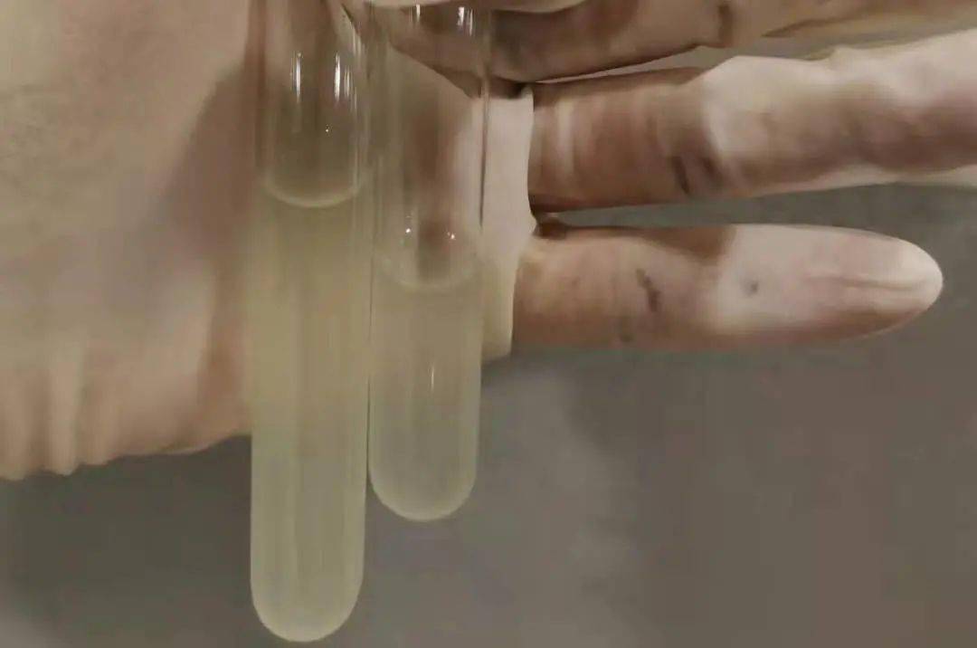 拔牙得了脑膜炎绍兴一女子险些丧命不是谣言赶紧看