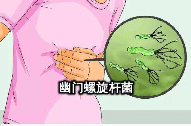 7b147cdf60a64faba851bd6583a2670a.png