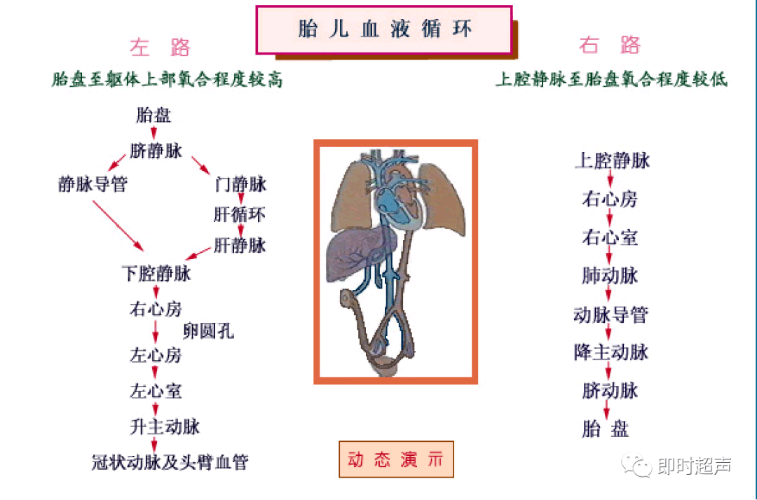 6种小儿常见先天性心脏病超声表现