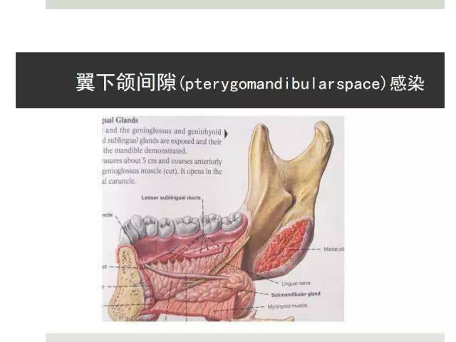 口腔颌面部间隙分布图图片