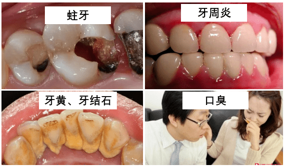 牙刷一个偷偷变美的小心机，只要一招好看十倍都不止！