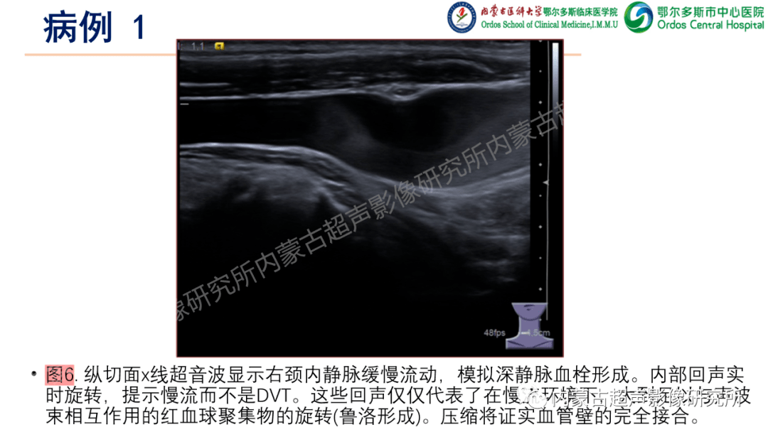 本文转载自其他网站,不代表健康界观点和立场.