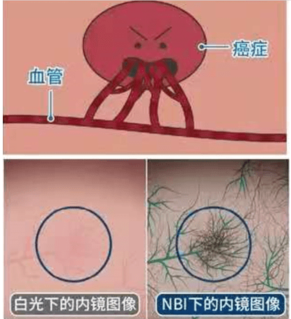 業界認可|最后3天！無痛胃腸鏡「特惠」檢查，活動倒計時……