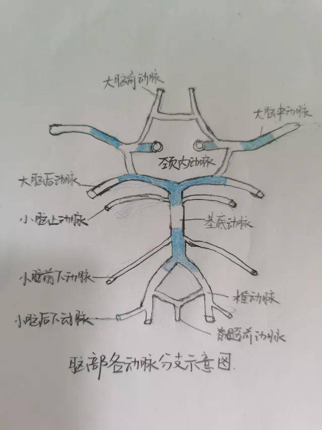 治疗|脑子里的“不定时炸弹“，急诊小护“画”给你看