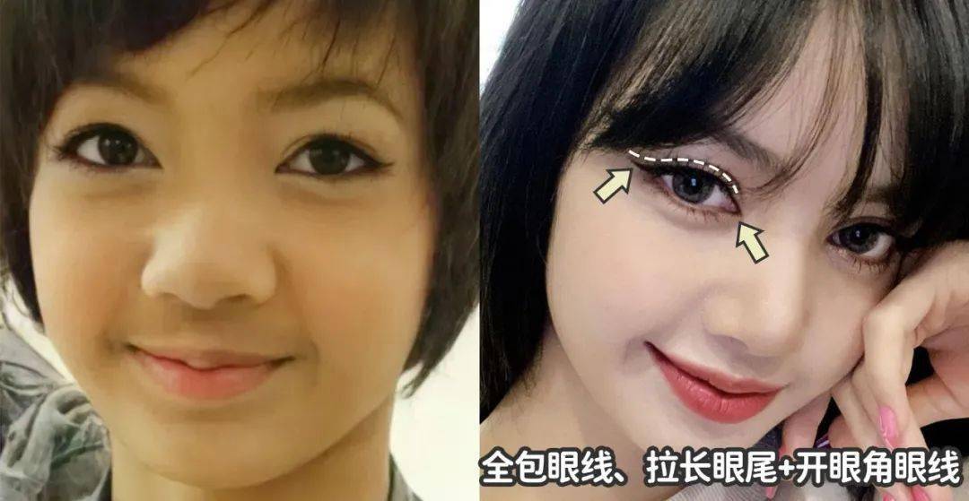 人间Lisa这是整了吗？人间芭比感怎么突然消失了？？