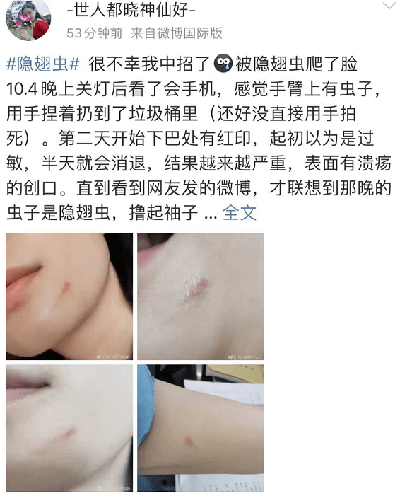 灯光|这种小虫，冲上热搜第一！医生紧急提醒