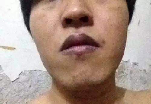 嘴唇一旦出现这个信号马上找中医