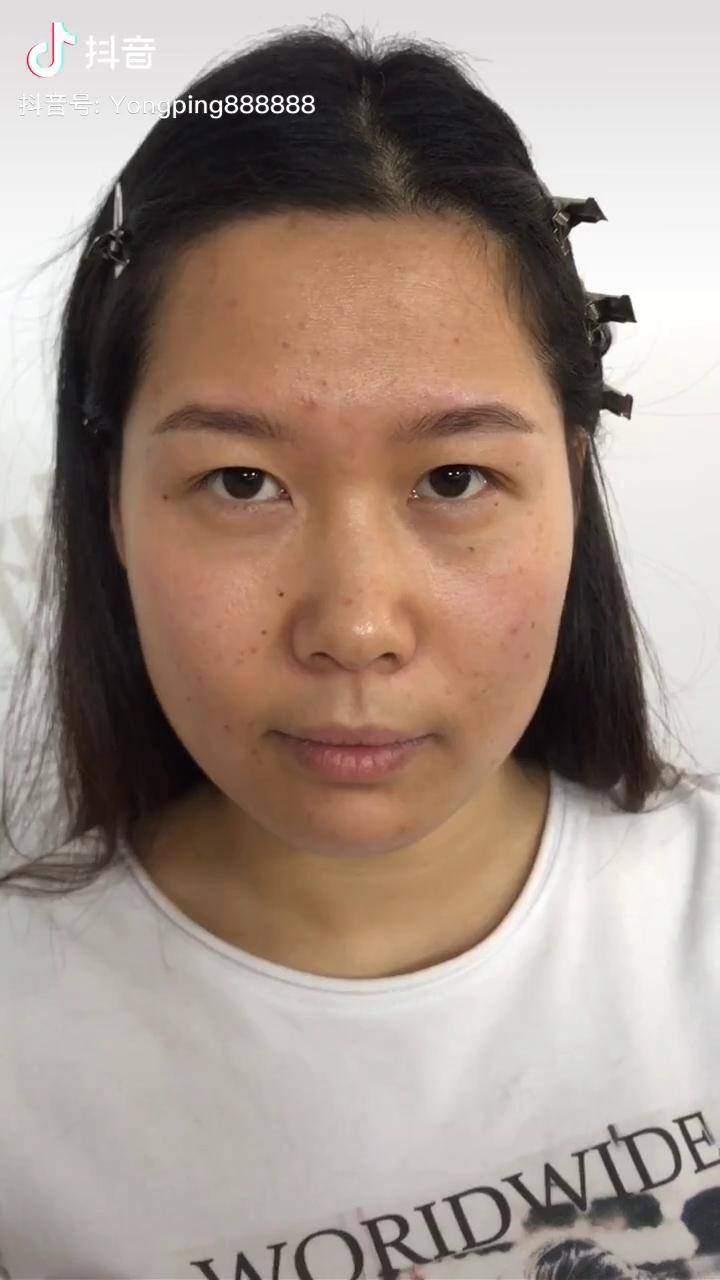无美颜无滤镜原相机真实痘痘肌妆容分享化妆不是魔术求轻喷