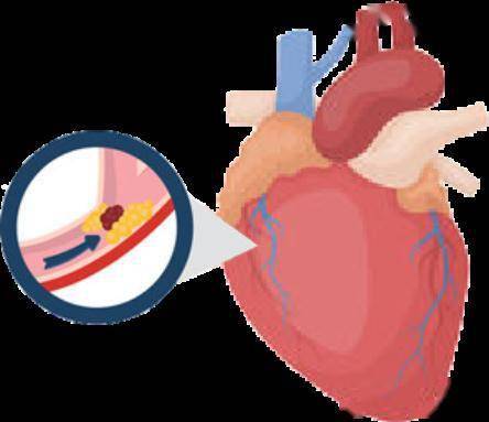 感觉|它是心梗、脑梗的元凶，更容易找上这些人