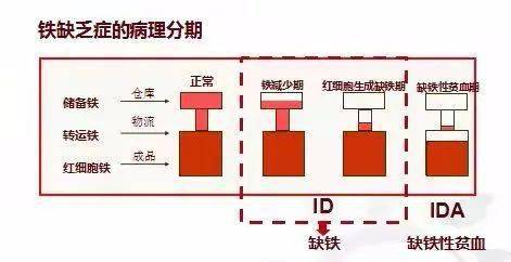 什么是儿童缺铁性贫血如何治疗