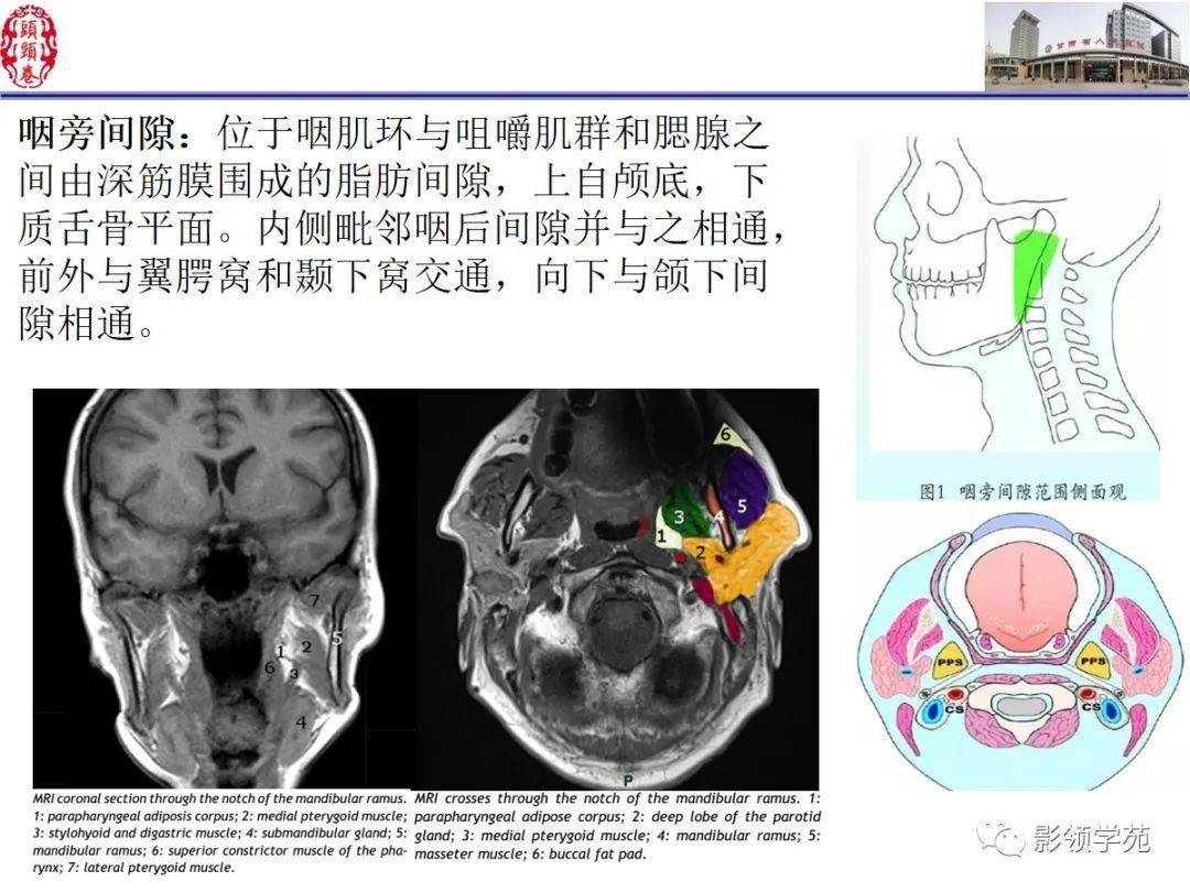 舌口底影像解剖及常见疾病影像诊断