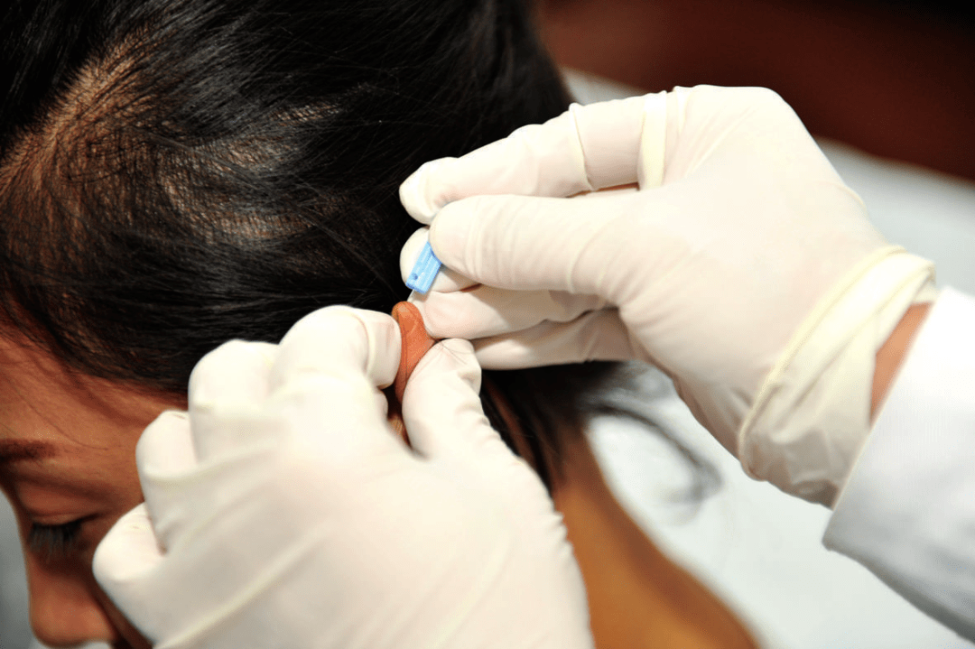 世界传统医药日| 中医外治 未病先防 改善亚健康