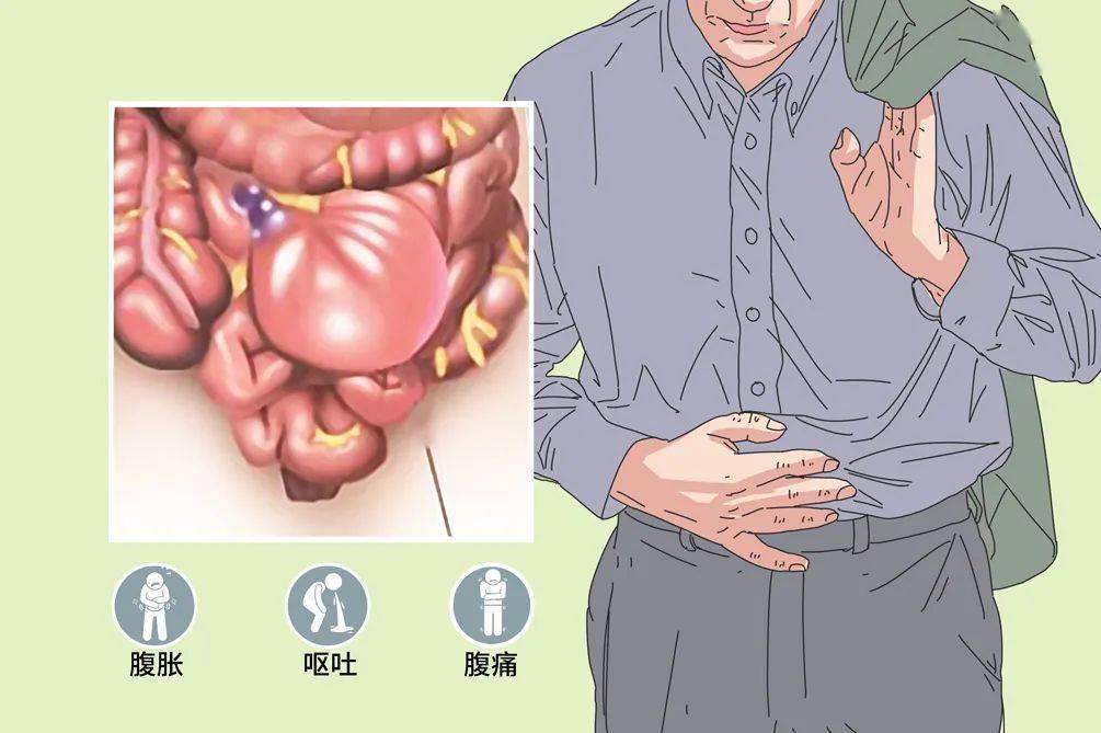 肠疼痛位置图图片