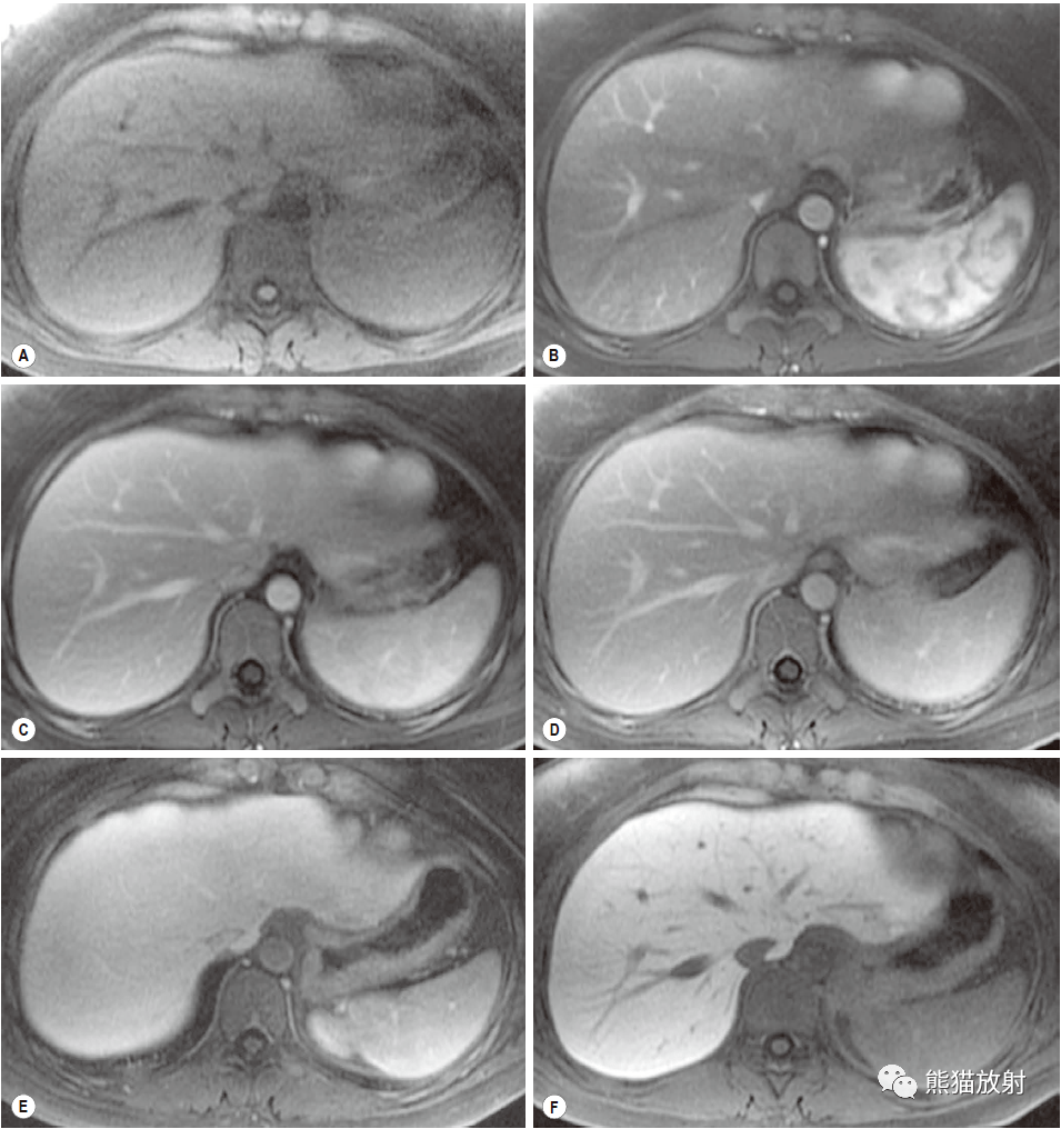 格艾选读丨肝脏影像检查技术（CT/MRI）_对比