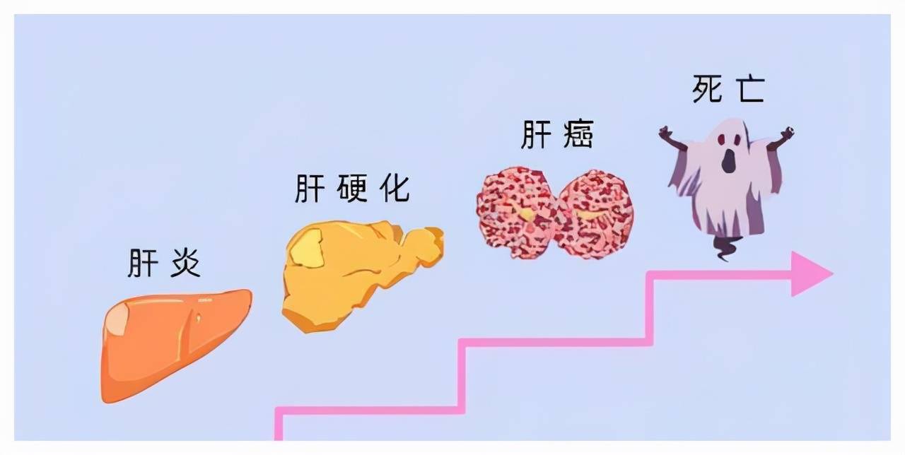 谁说肝癌早期没有症状只是你误诊了记好这8大早期症状