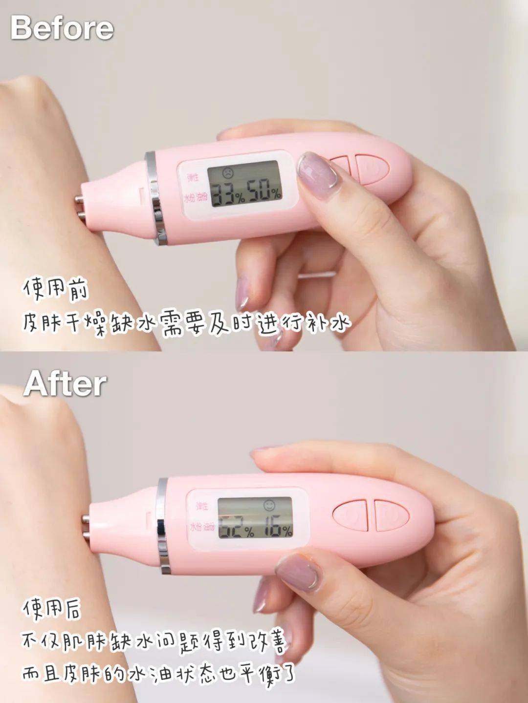 果酸单方面宣布退出鸡皮圈！秋冬超实用身体护理分享！！