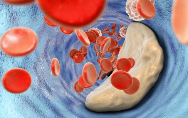 餐桌上常见的十二种降血脂的食物,你都吃过几种?_胆固醇