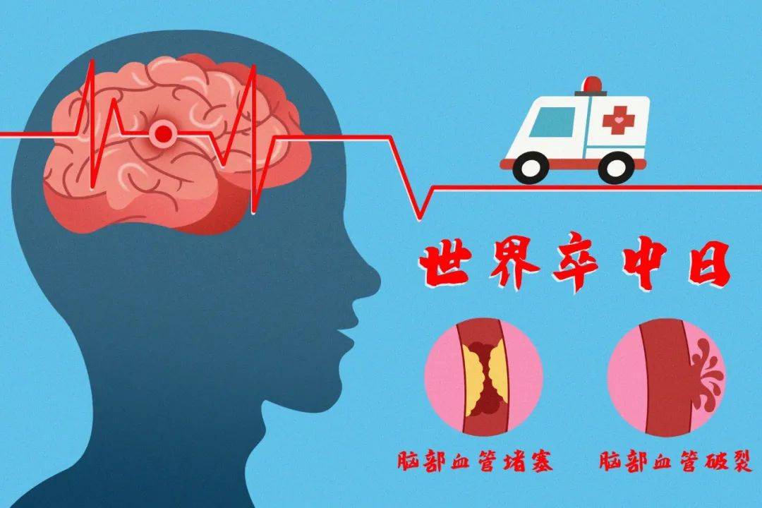 治疗|男子才30多岁就中风了！我国患病人数超2800万，这些症状要当心