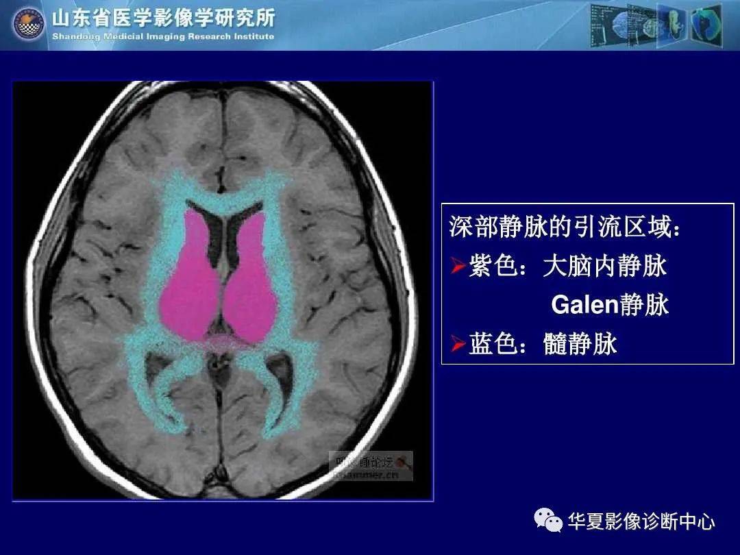 诊断|缺血性脑血管病的影像诊断