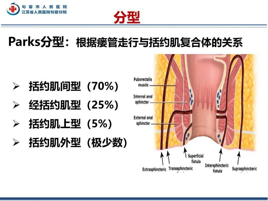 歪门邪道:肛瘘影像评估_解剖图