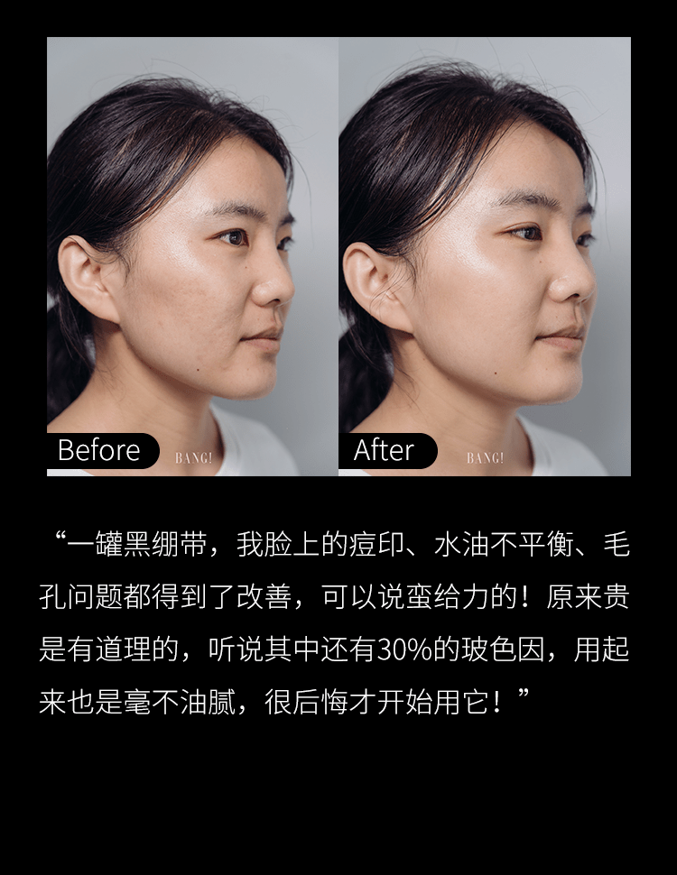 绷带黑绷带YYDS