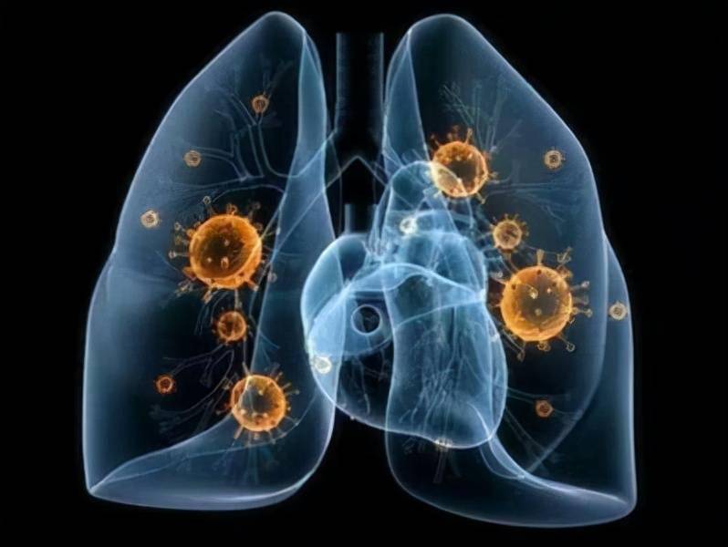 阳性|江苏常州新增3名新冠病毒核酸检测阳性人员