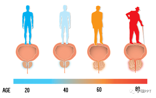 前列腺增生手术患者的护理查房_膀胱