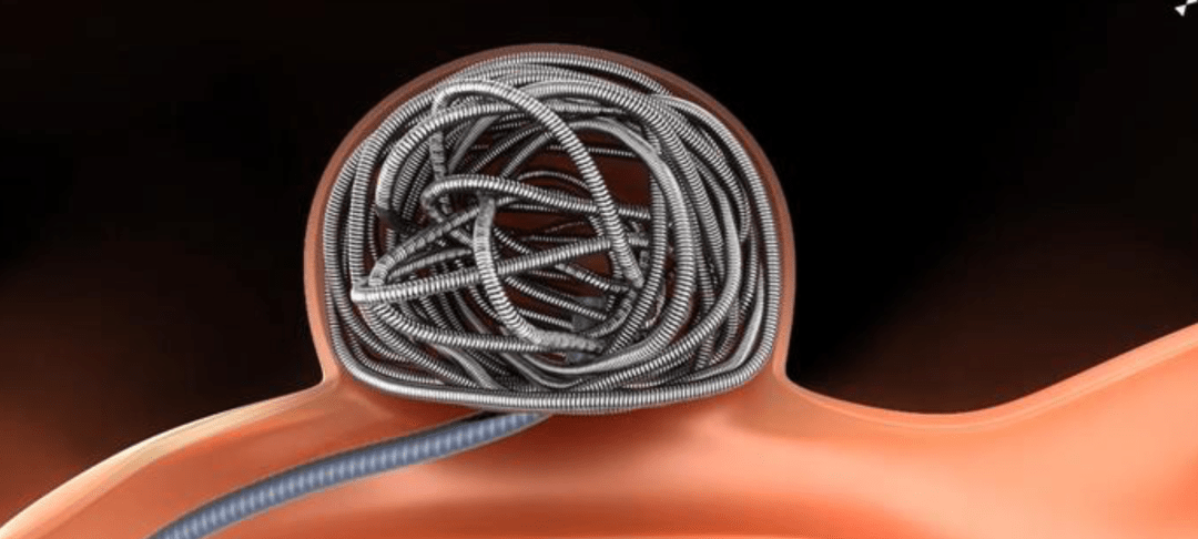 《关于公布硬脑(脊)膜补片,疝补片,弹簧圈(颅内)三类河北省医用耗材