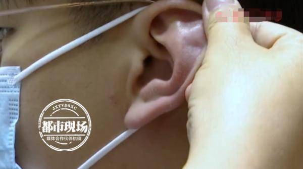 耳屎|她老爱掏耳朵，竟掏出恶性肿瘤？！