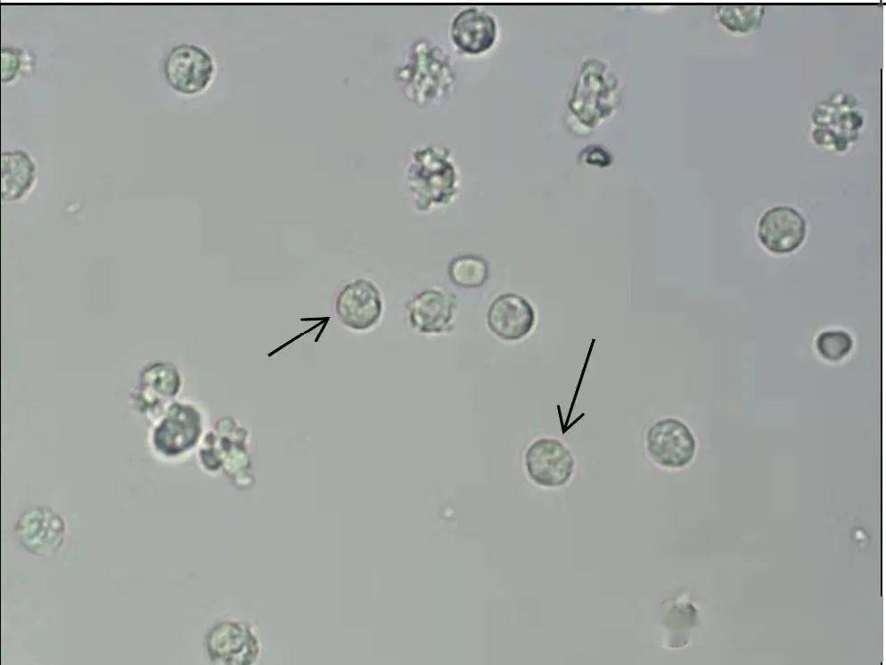 白细胞未染色图片