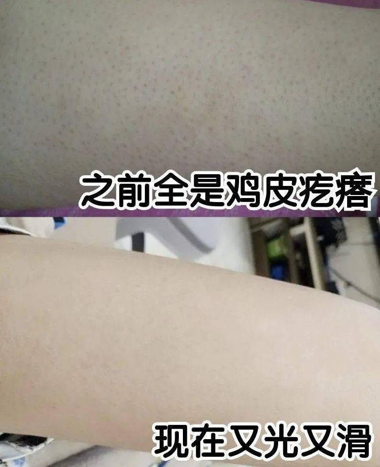 南宁这瓶身体乳还不入手？保湿+锁水+祛痘印！【1074主播严选商城】