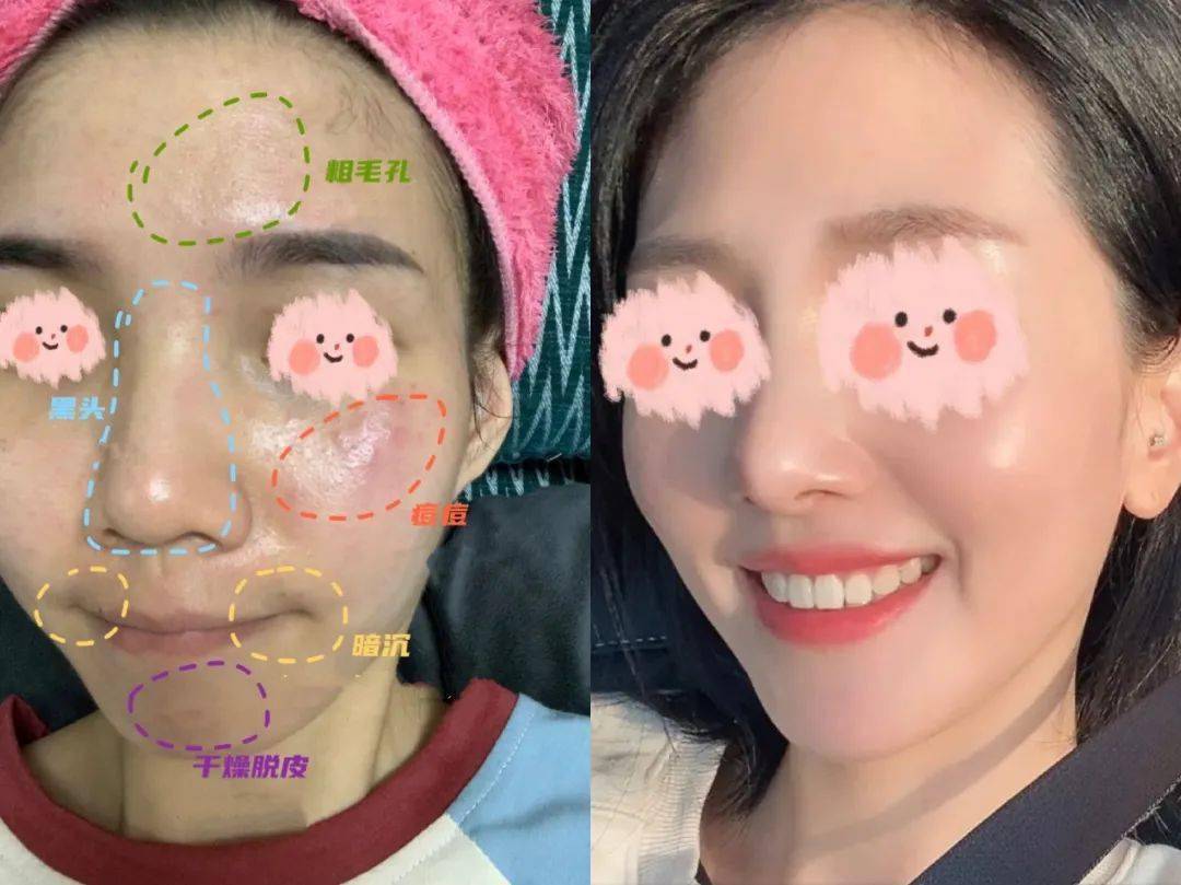 金盏花（抢完就删）?女明星巨爱囤的护肤牌，今天比双11便宜！