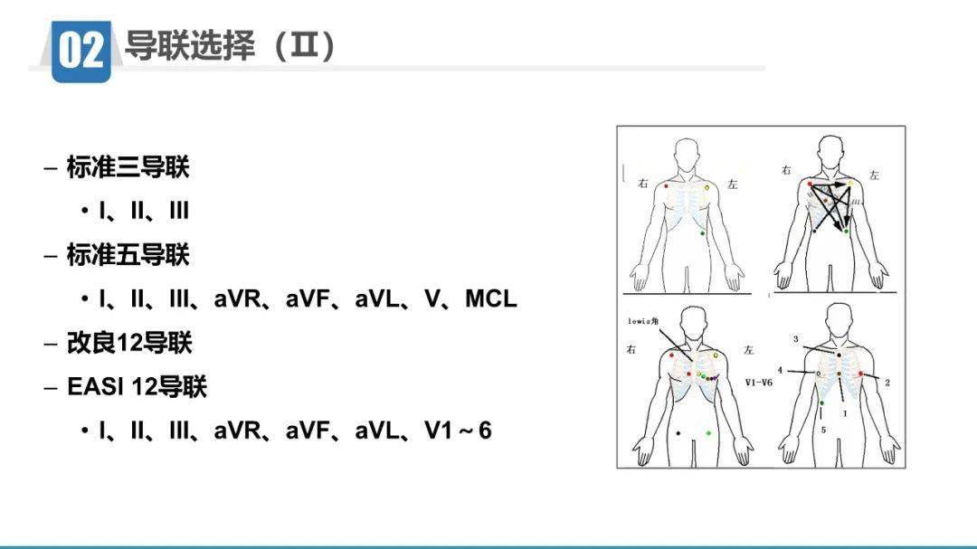 心電監護儀的應用與護理