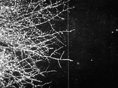 体检|深圳一女子23年从未做过体检，一次就中招！胆囊里密密麻麻全是瘤