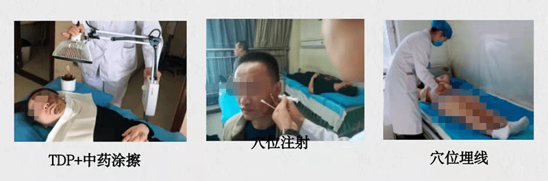 技术|【义诊通知】医院11月22日举办“世界针灸日”义诊活动