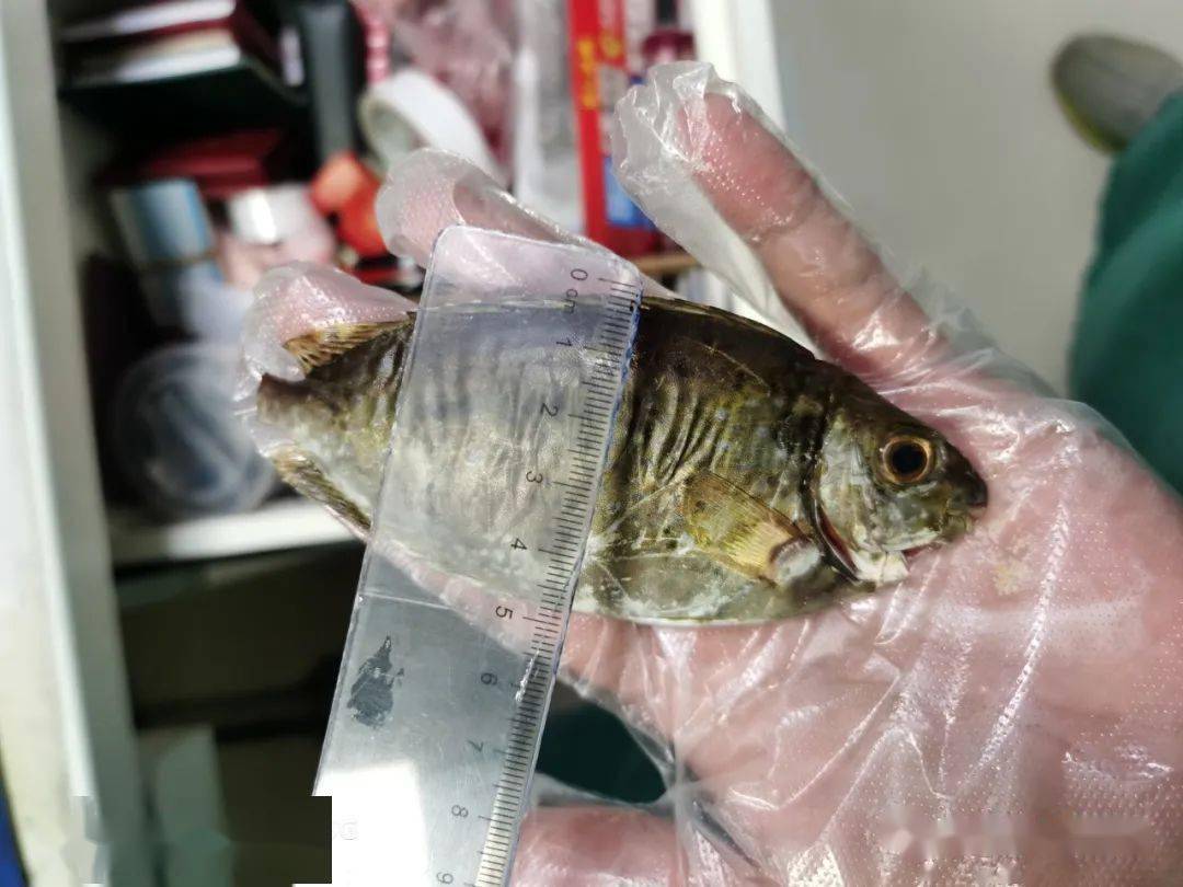 北海一妇女被泥猛鱼鱼鳍刺中右手大拇指"无法自拔"_陈女士