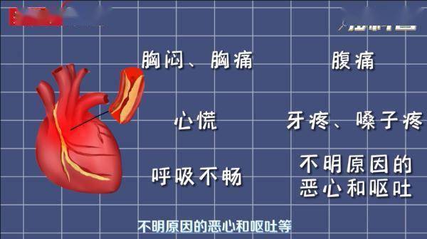 救治|别以为你年轻，就不会心梗！