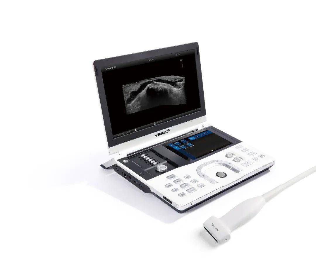 vinno 8轻松识破_超声