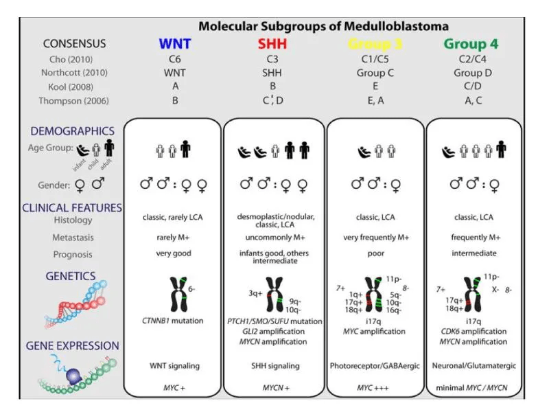 髓母細胞瘤分型有哪些