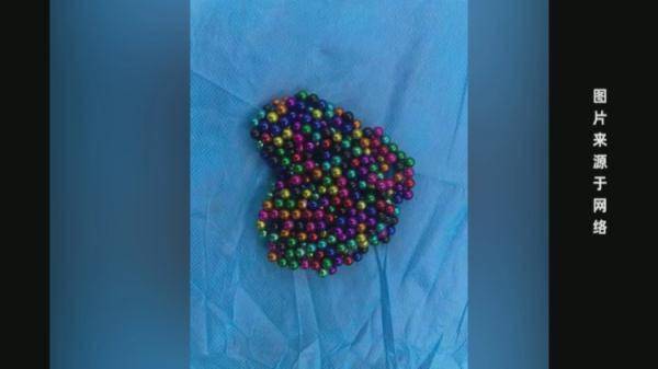 家长|4岁男童出现咳嗽、发烧症状，结果胃里取出34颗磁力珠……