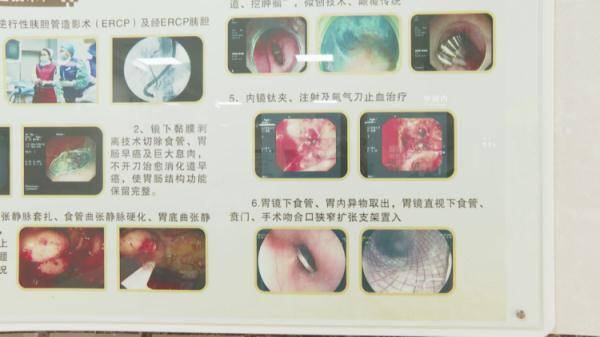 家长|4岁男童出现咳嗽、发烧症状，结果胃里取出34颗磁力珠……