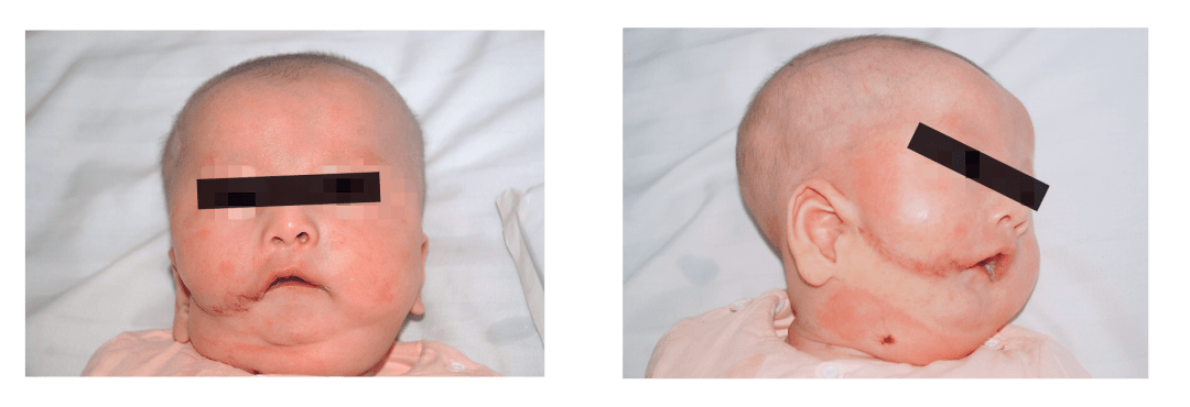 裂隙|左脸微笑的孩子