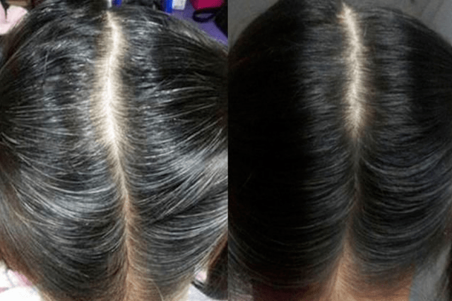 ① 规律作息不良的生活习惯也是造成头发变白的因素之一,现在大部分人