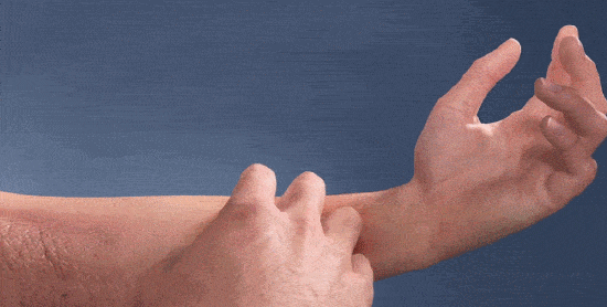 说明书|皮肤凝胶 清疹帮手