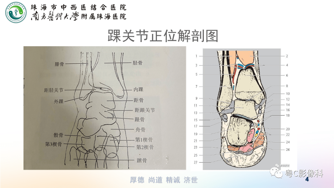 踝关节x线解剖 解剖图图片