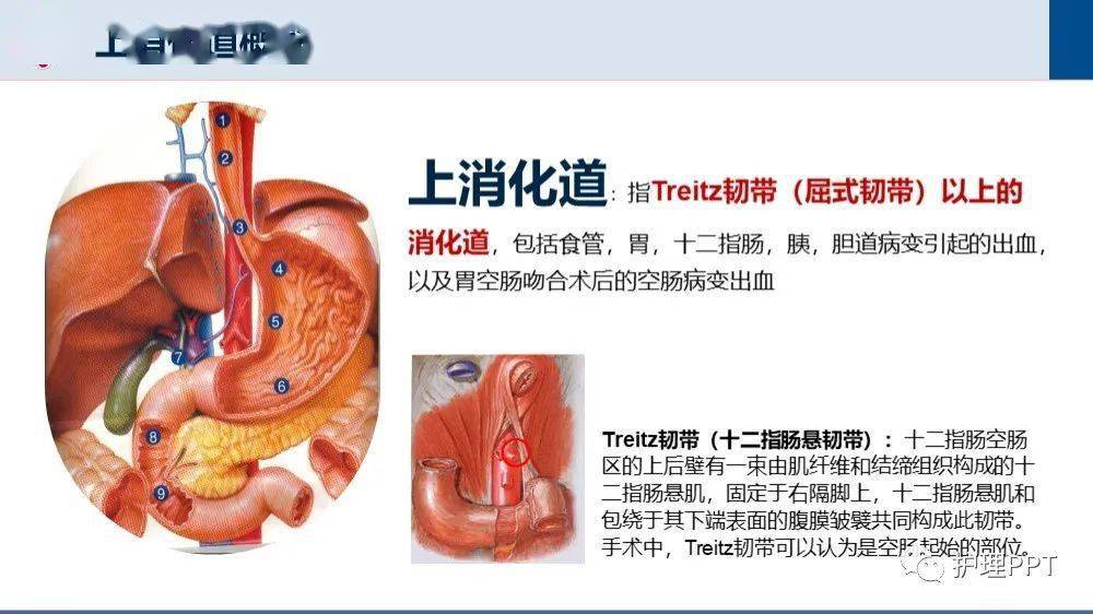 【ppt】上消化道出血護理查房_病變_空腸_微信